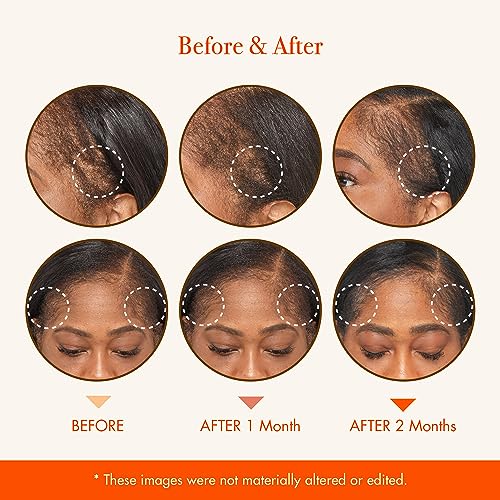 KISS Hair Growth Oil Hair Strengthening Oil Made 4.5Oz