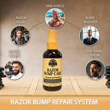 Okay Razor Bump Care 4oz Soothing Aftershave Treatment for Smooth, Healthy Skin-2